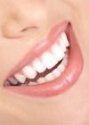 �C�mo tener la mejor sonrisa?