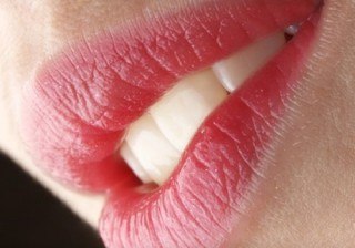 Herpes labial: prevención y soluciones