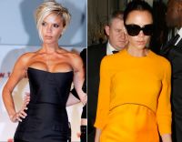 Los pechos operados de Victoria Beckham antes y después