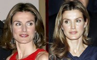 Letizia Ortiz se oper� de la nariz y el ment�n para corregir su perfil y dulcificar sus facciones