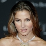 Elsa Pataky se retoc� los p�mulos