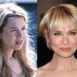 El antes y el despu�s de Ren�e Zellweger