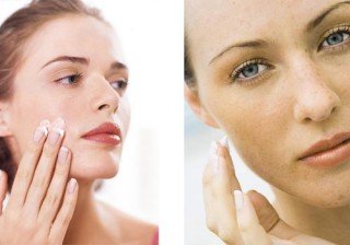 Reducir cicatrices ¿cómo