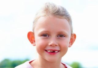 Orejas de soplillo ¿cómo acabar con ellas