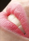 Herpes labial: prevención y soluciones