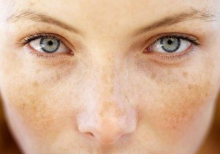 Trucos de maquillaje para tapar las manchas solares