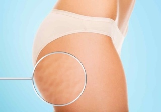 Lo que sí funciona para levantar los glúteos ¡consigue el culo perfecto!