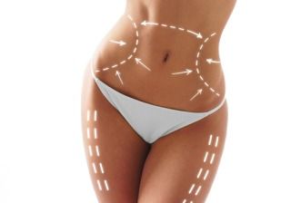 Todo lo que debes saber antes de hacerte una liposucción