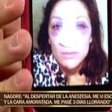 Nagore Robles con la nariz escayolada y la cara amoratada