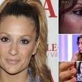 El antes y después de Nagore Robles tras su operación de nariz