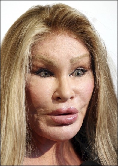 Foto Jocelyn Wildenstein y su obsesión por el bisturí
