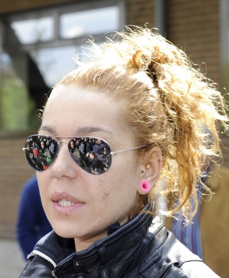 Foto Sofía Cristo con acné Foto Sofía Cristo con acné