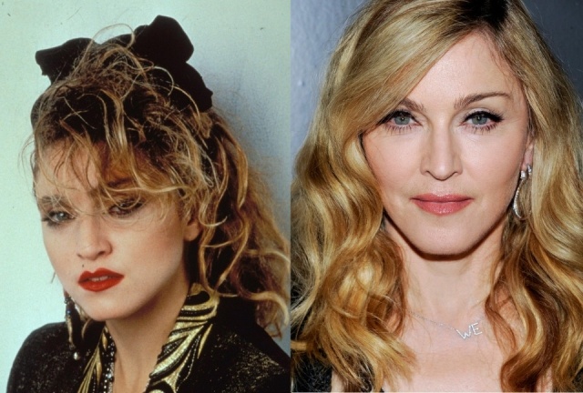 Foto El antes y el después de Madonna