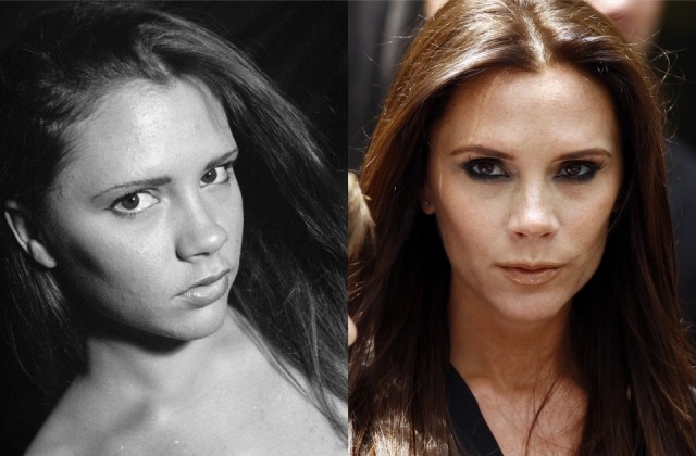 Foto El antes y el después de Victoria Beckham