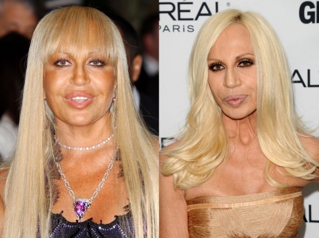 Foto El antes y el después de Donatella Versace