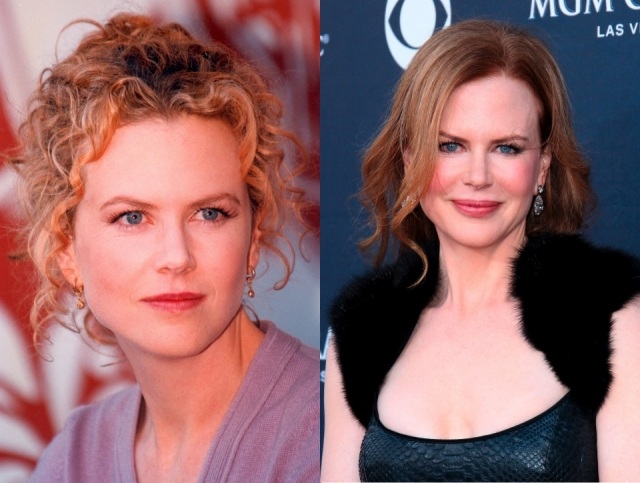 Foto El antes y el después de Nicole Kidman