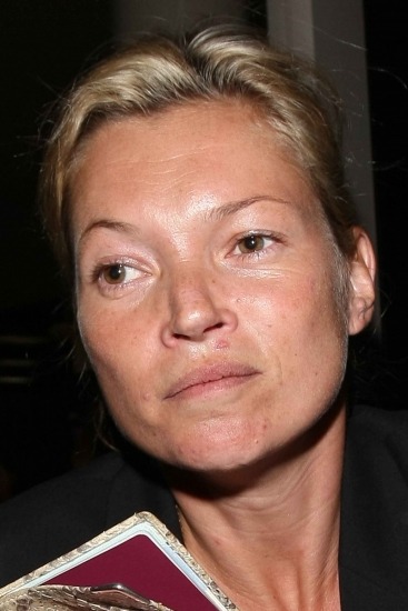 Foto Kate Moss, una top que no se libra del acné