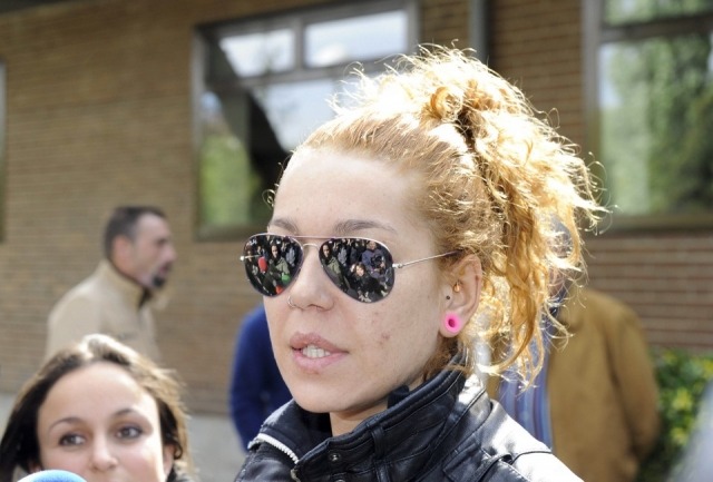 Foto Sofía Cristo no se libra del acné