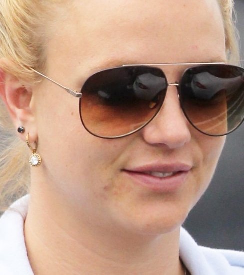 Foto Britney Spears no puede ocultar su acné
