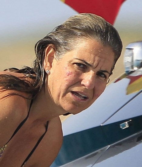 Foto Arantxa Sánchez Vicario sufre de acné en verano
