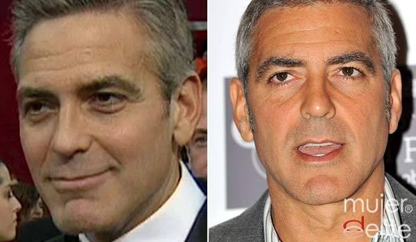 Foto George Clooney se suma a la moda de pasar por el quirófano y se quita las bolsas de los ojos