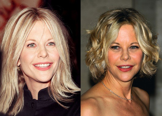 Foto Meg Ryan, antes y después de la cirugía estética
