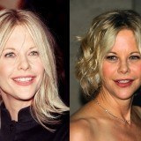 Meg Ryan, antes y después de la cirugía estética