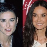 Demi Moore protagoniza otro impactante antes y después de la cirugía estética
