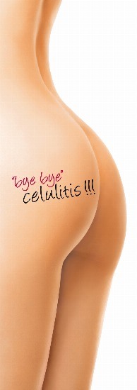 Foto Medidas básicas contra la celulitis