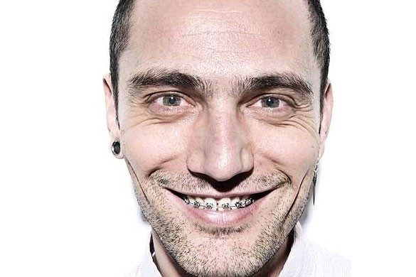 Foto David Delfín luce ortodoncia para separar sus dientes