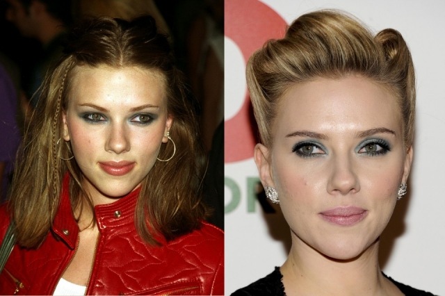 Foto Scarlett Johansson ha afinado su nariz gracias a la cirugía estética