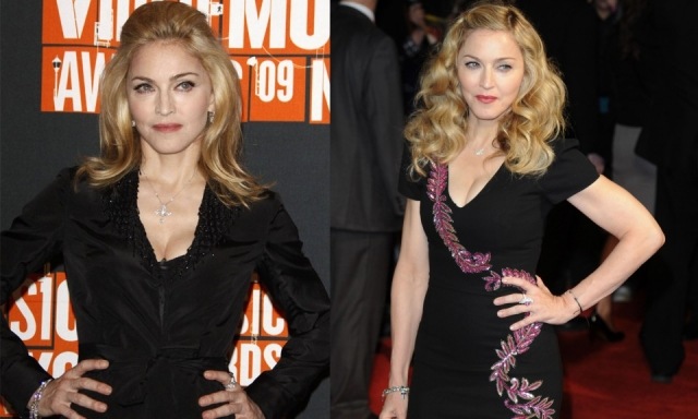 Foto Las operaciones faciales de Madonna son numerosas