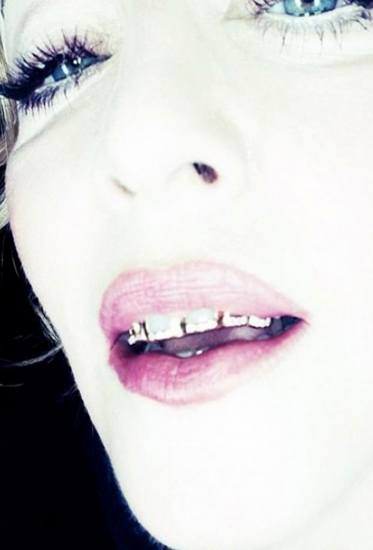 Foto Madonna es una de las últimas celebrities en sumarse a la moda de las fundas dentales de oro
