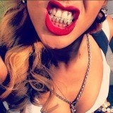 Rihanna no duda en mostrarnos su funda dental de oro y diamantes